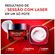 473235---dermo-revitalift-laser-x3-6