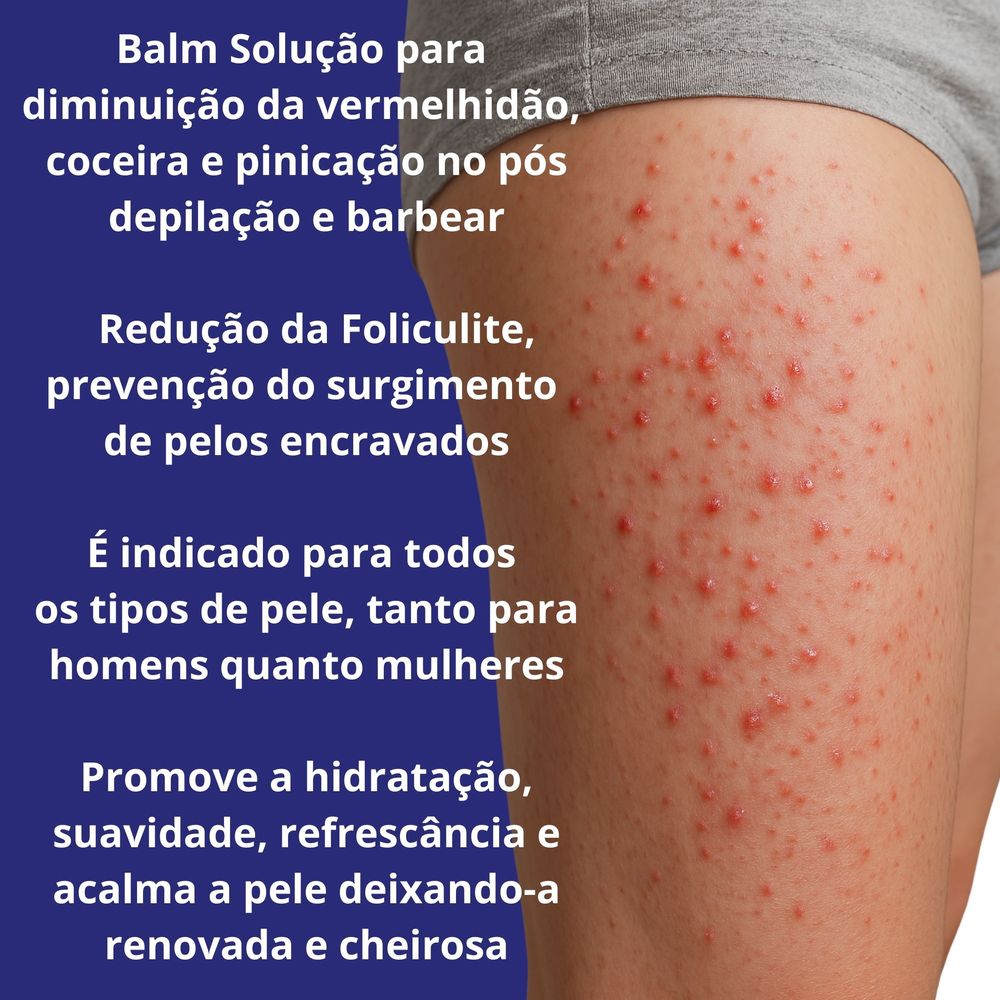 Creme Para Foliculite No Gluteo Virilha Coxa Pelo Encravado - Drogaria ...