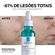 749532---Serum-La-Roche-Posay-Effaclar-Ultra-Concetrado-30ml-5