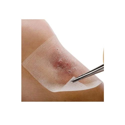 Curatec Compressa em Petrolatum 7,6 X 7,6cm Unidade 7,6 X 7,6 Único Único Curatec Compressa em Petrolatum 7,6 X 7,6cm Unidade 7,6 X 7,6 Único Único