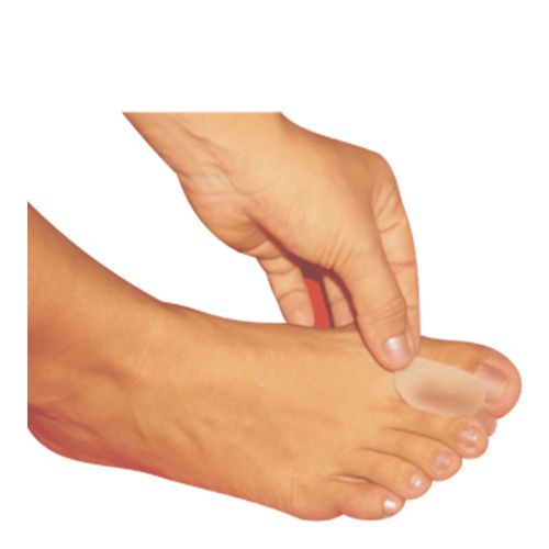 9009980---corretivo-para-joanete-skingel-sg-101-ortho-pauher 9009980---corretivo-para-joanete-skingel-sg-101-ortho-pauher