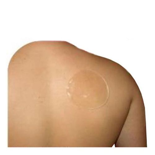 9010798---disco-skingel-10-cm-sg-201-ortho-pauher 9010798---disco-skingel-10-cm-sg-201-ortho-pauher